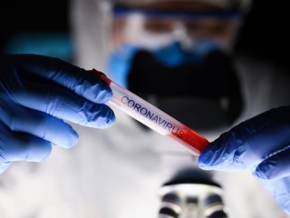 Rekor Tertinggi, Positif Covid-19 di Indonesia Bertambah 1.853 Orang 