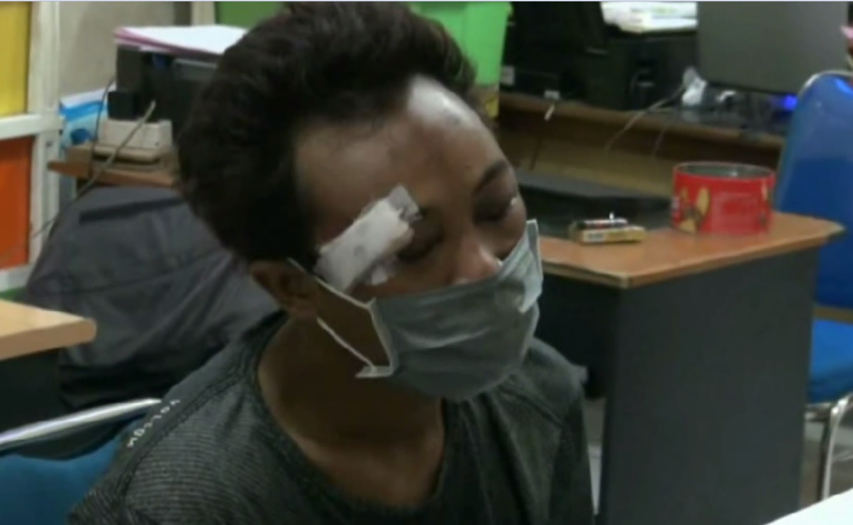 Teman Kabur, Maling Motor di Minimarket Waru Babak Belur