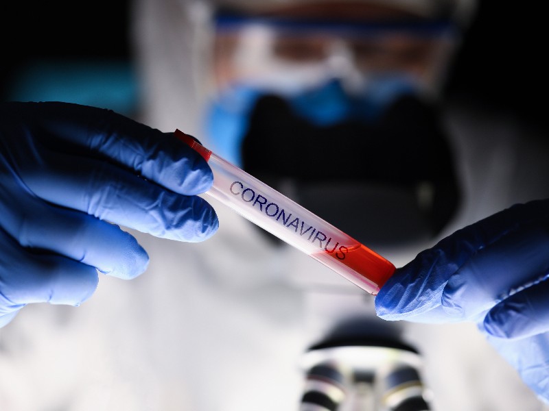 Mau Donor Plasma Darah Konvalesen? Yuk, Simak Persyaratannya