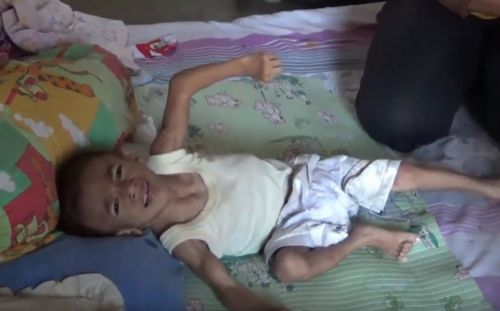 Muhammad Bakri, balita asal Probolinggo penderita cerebral palsy. (metrotv)