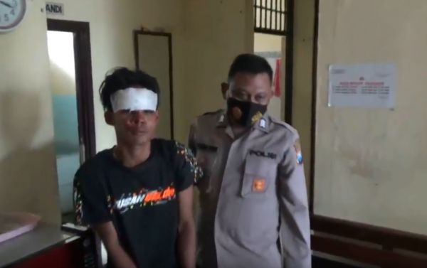 Jambret Pasuruan Keok di Tangan Korban Perempuan