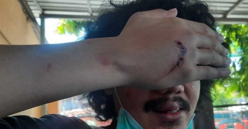 Suki menunjukkan luka akibat perampasan yang dialaminya (Foto/ Istimewa)