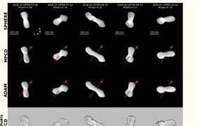 Kleopatra, Asteroid Aneh Berbentuk Tulang Mengitari Matahari