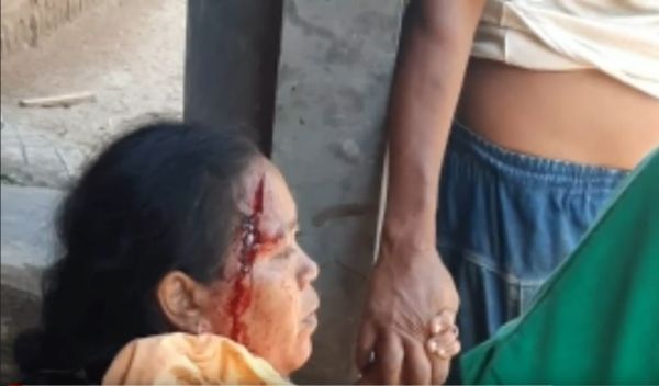 Keluar Hutan, Kera Liar Cakar Warga Magetan