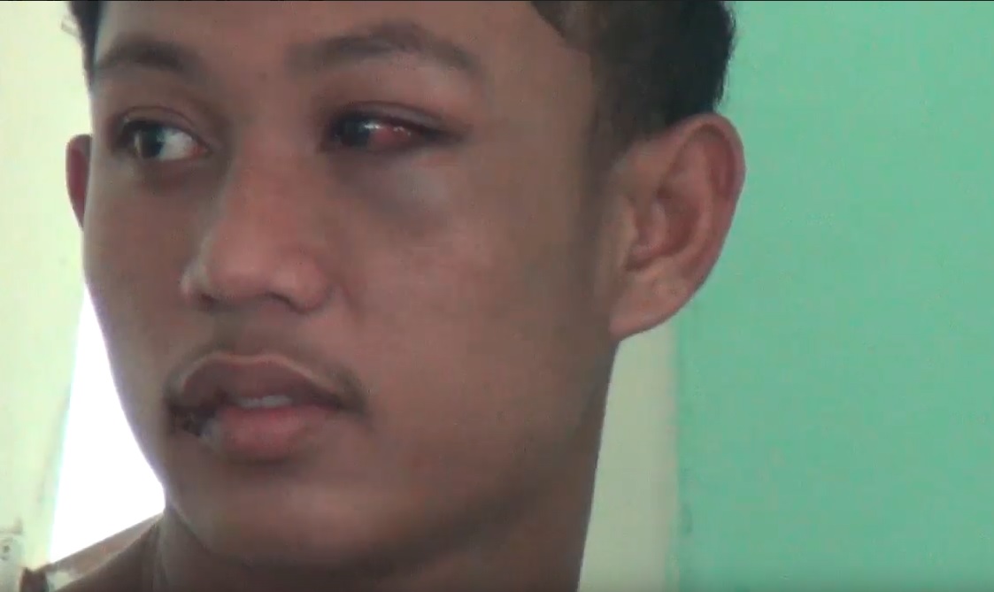  Syamsul mengalami luka lebam di bagian mata dan bibir usai dihajar dua oknum tim sukses Pilkades Sumenep. (metrotv)