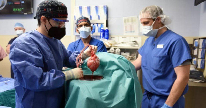 Ahli Bedah Translantasikan Jantung Babi ke Manusia (Foto: University of Maryland Medical Center)