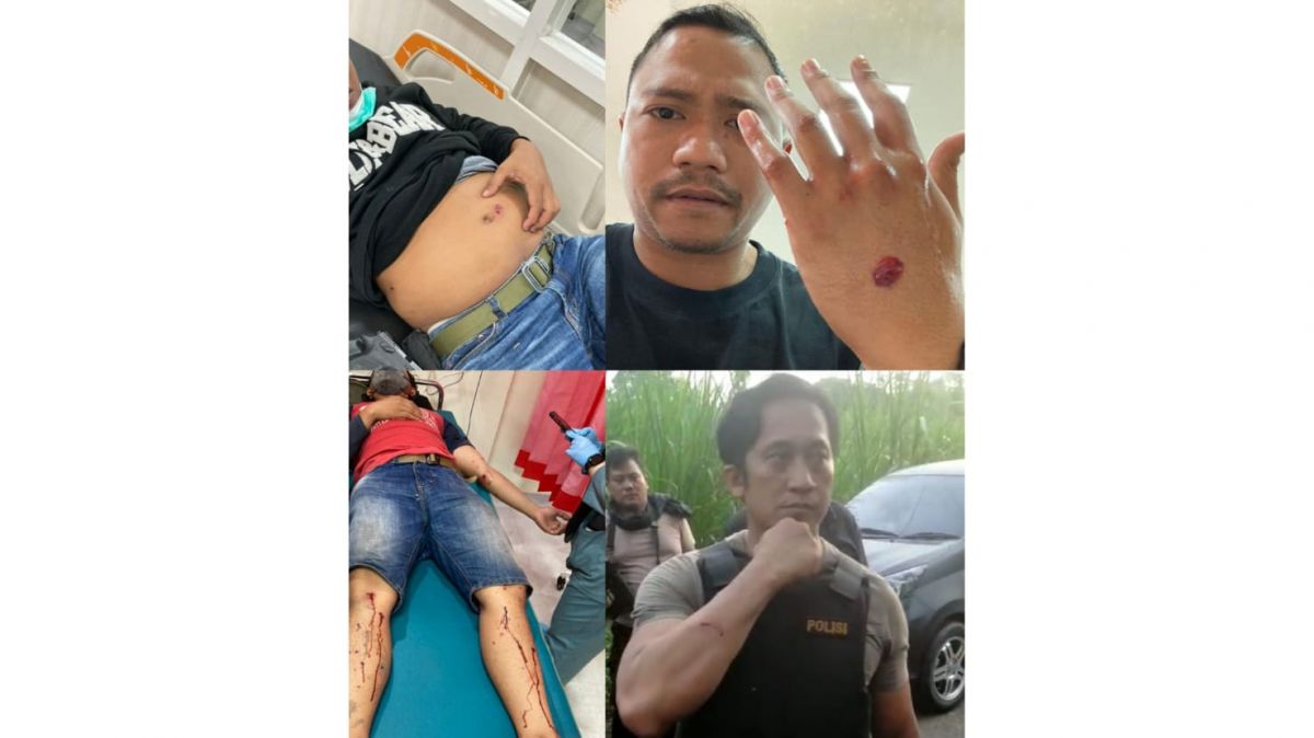 4 anggota polisi Pasuruan menunjukkan luka usai dilempar bondet (Foto / Istimewa) 
