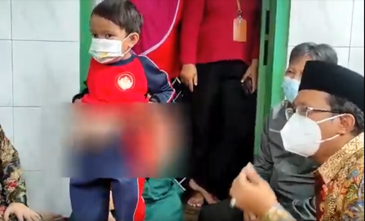 Bupati Sidoarjo Ahmad Muhdlor Ali datang langsung ke rumah penderita gastroschisis/metrotv