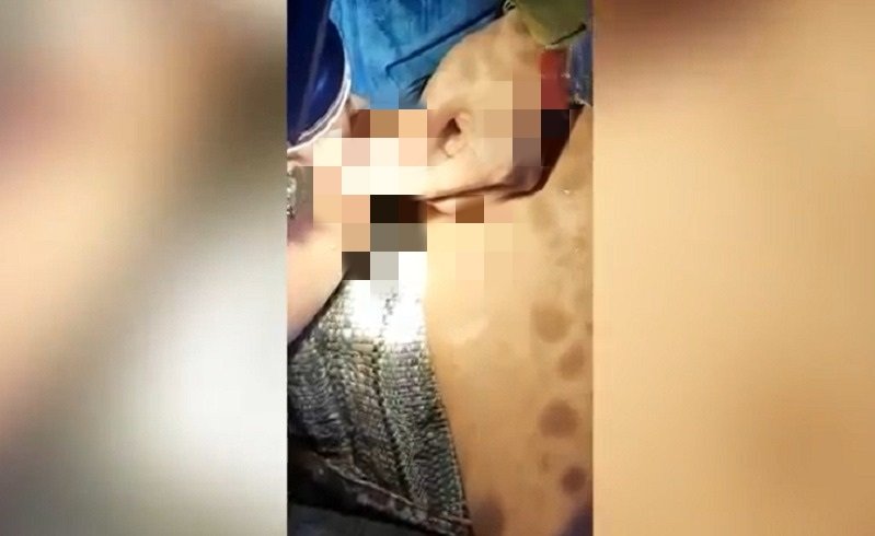 Tangkapan layar saat petugas pemadam kebakaran berupaya melepas tindik dari kemaluan RZ (Foto / Metro TV)