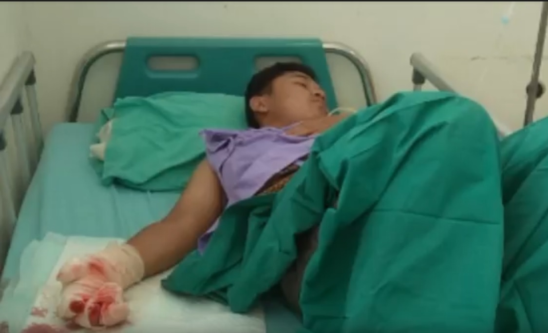  Iqbal tergeletak di rumah sakit setelah tiga jarinya hancur terkena ledakan petasan/metrotv