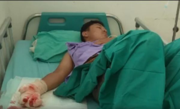 Petaka Main Petasan, Tiga Jari Hancur Terkena Ledakan