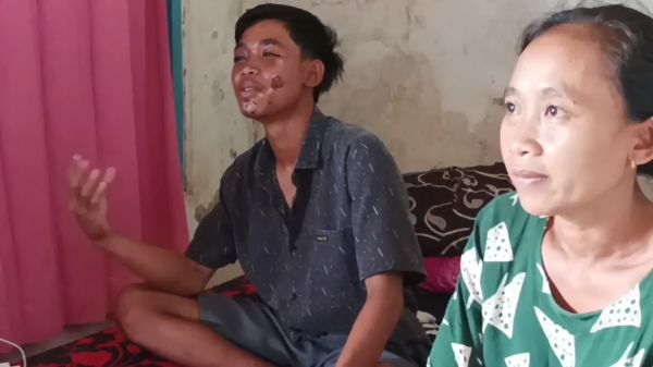 Kesaksian Korban Selamat dari Tragedi Kanjuruhan, Belum Dapat Bantuan hingga Utang untuk Biaya Pengobatan