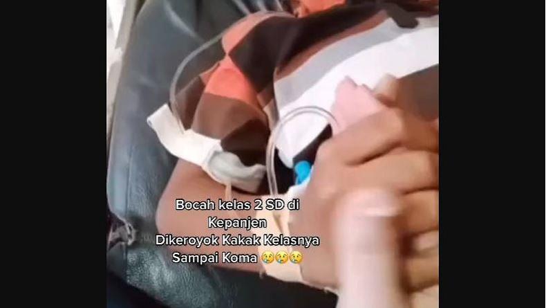 Bocah SD Korban Penganiayaan Kakak Kelas di Malang Jalani Operasi