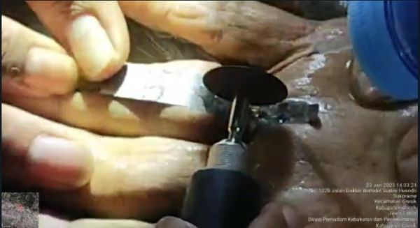 2 Jarinya Bengkak akibat Cincin, Nenek di Gresik Dilarikan ke Kantor Damkar