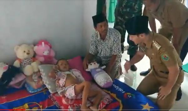 Alhamdulillah, Kondisi Balita Tertembak Senapan Angin di Kepala Mulai Membaik