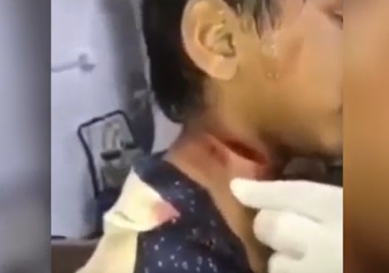 Video Anak Korban Penculikan Disayat Lehernya Dipastikan Hoax