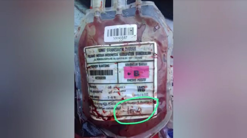 Kantong darah bertuliskan HIV ditemukan di tempat sampah di Bangkalan (Foto / Istimewa)